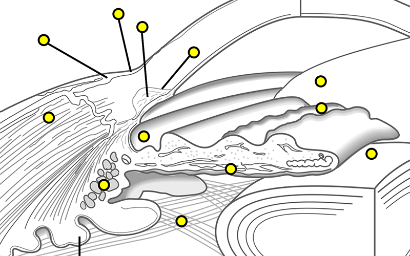 Anterior Chamber Angle and Ciliary Body